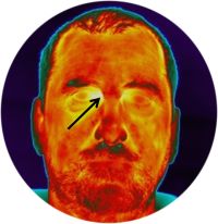 Infrared Body Temperature Screening